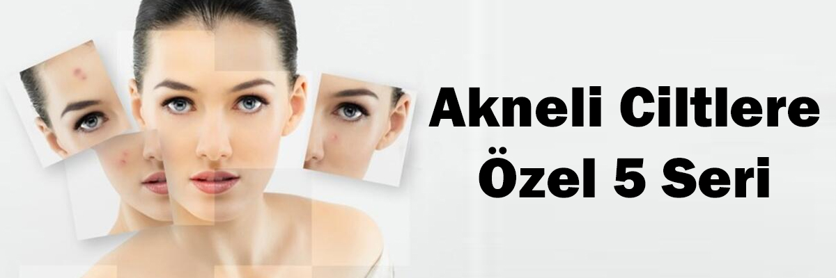 Akne ve Sivilceye İyi Gelen 5 Özel Krem